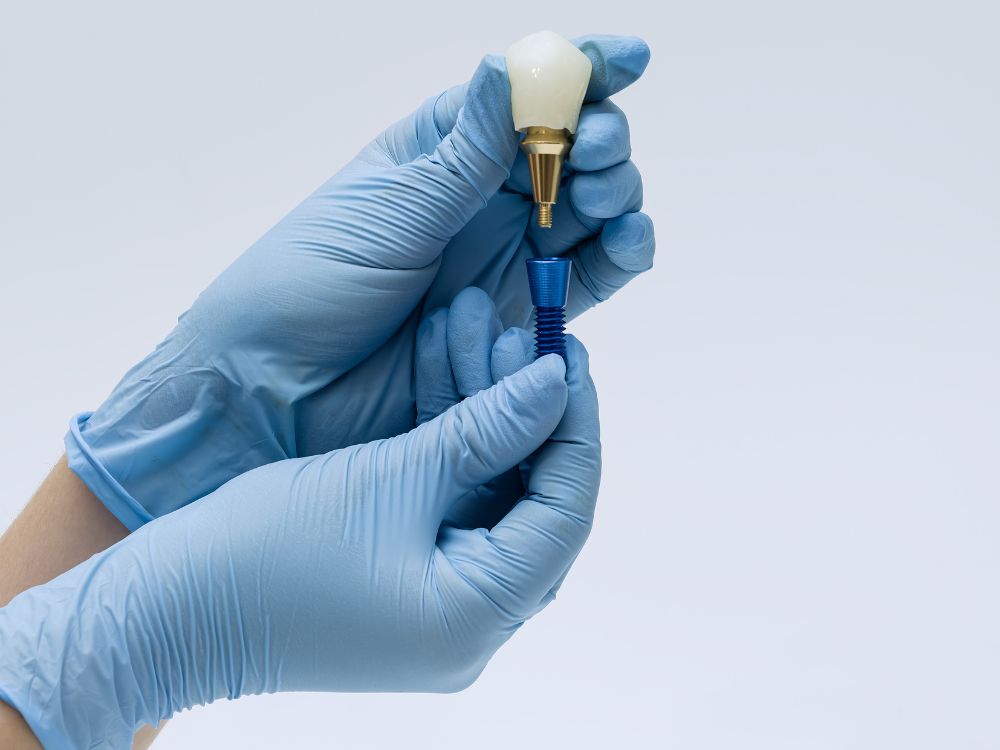 Profissional segurando componente do melhor tipo de implante dentário durante procedimento odontológico.