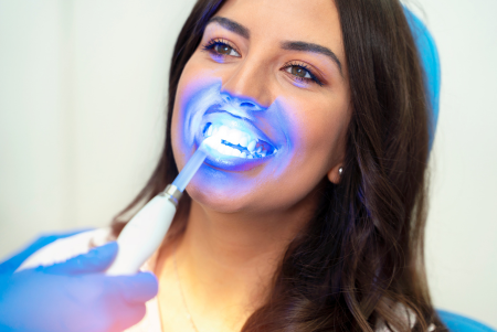 Como funciona o Clareamento Dental - Clareamento Dental em Blumenau - Mordent