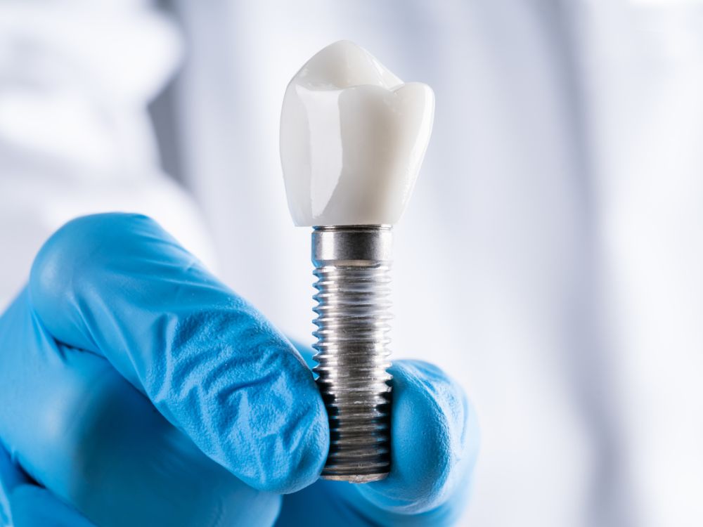 O implante dentário é seguro
