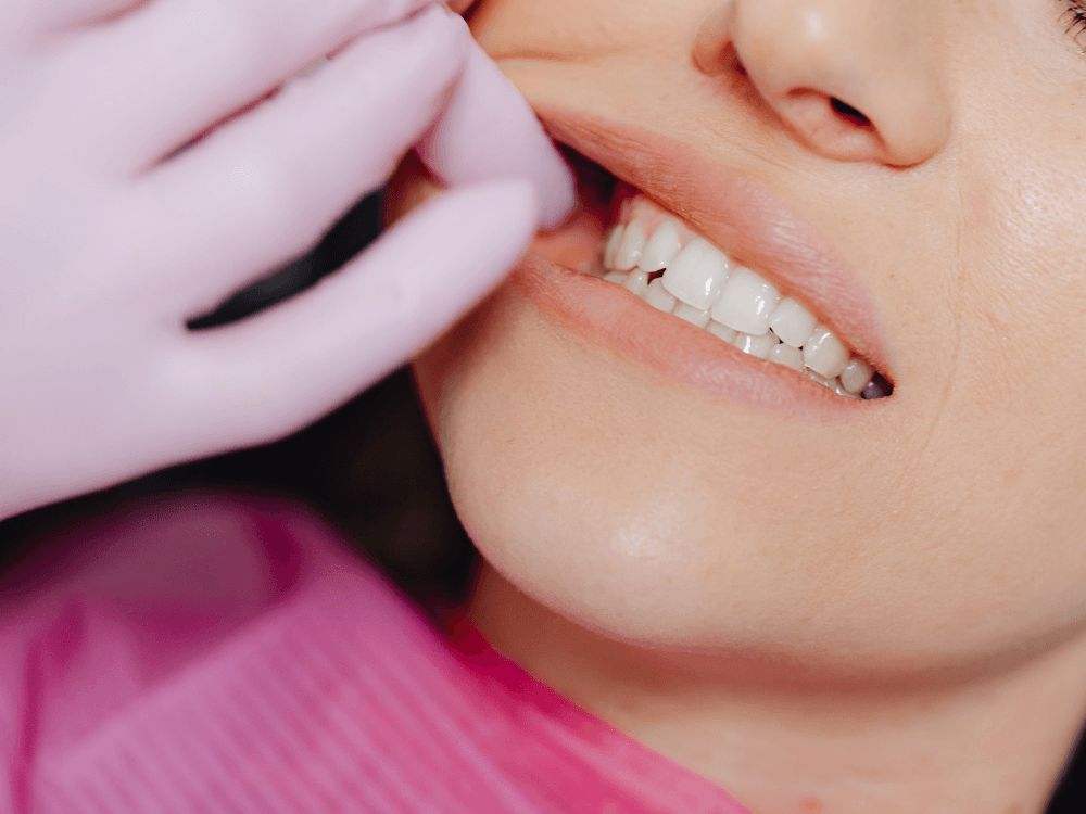 Dentista examina os dentes de uma paciente durante consulta para avaliar possibilidades de reposição dentária
