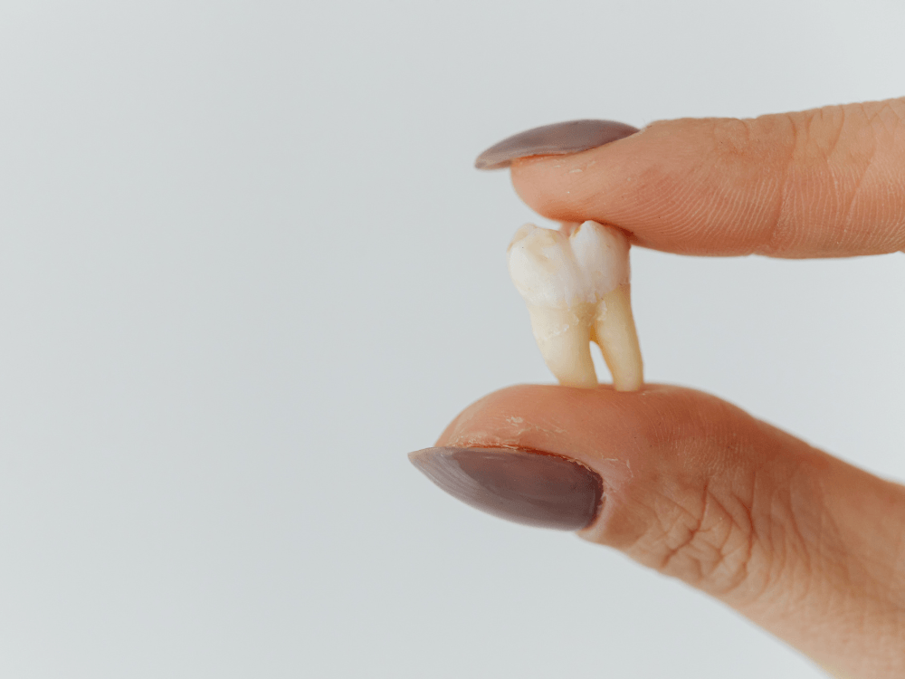 Dente natural é segurado entre os dedos, representando a perda dentária e a necessidade de buscar uma forma de reposição