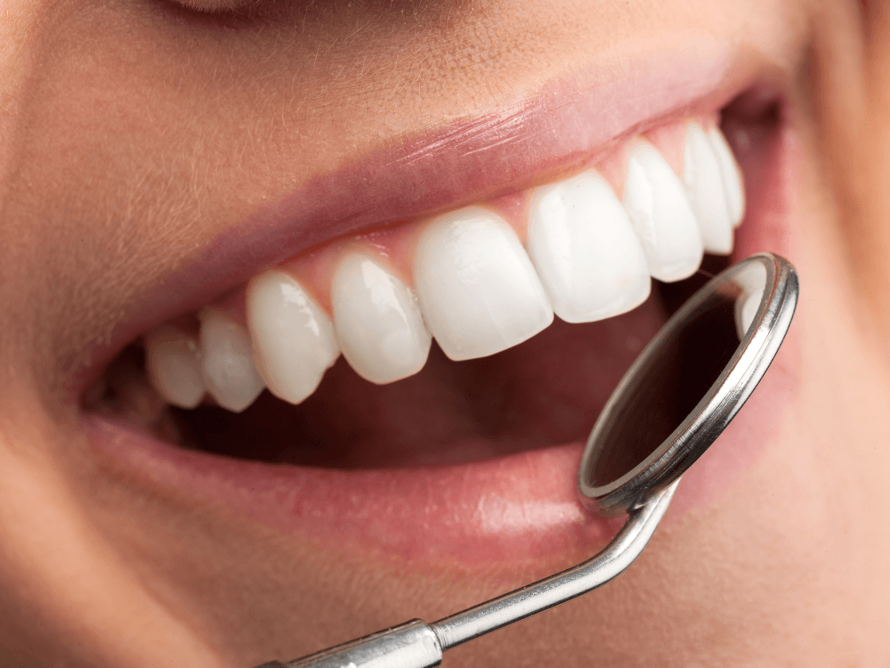 Pessoa com dentes brancos e espelho odontológico próximo à boca durante uma avaliação da saúde bucal relacionada a próteses dentárias. Tudo para explicar quanto tempo dura um implante de porcelana.