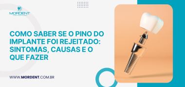 Capa do artigo sobre como saber se o pino do implante foi rejeitado, com ilustração de implante dentário desmontado e logotipo Mordent.