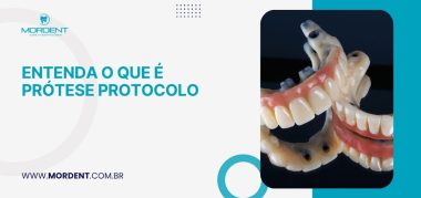O que é prótese protocolo?
