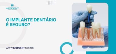 O implante dentário é seguro?