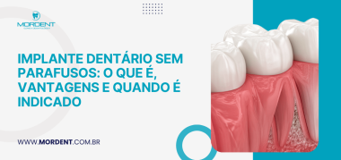 Arte de capa sobre implante dentário sem parafusos com ilustração da estrutura do implante e título informativo do conteúdo.