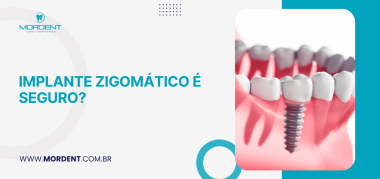 Capa do artigo sobre implante zigomático com ilustração de implante dentário e pergunta sobre a segurança do procedimento.