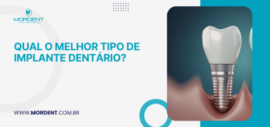 Arte informativa destacando melhor tipo de implante dentário com imagem ilustrativa de implante e identidade visual de clínica odontológica