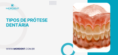 Arte ilustrativa sobre tipos de prótese dentária com imagem de dentadura completa e identidade visual da clínica.